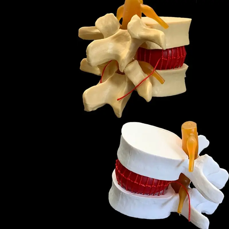 Examination Bed Medical - Vertebre lombari umane anatomiche Modello dimostrativo