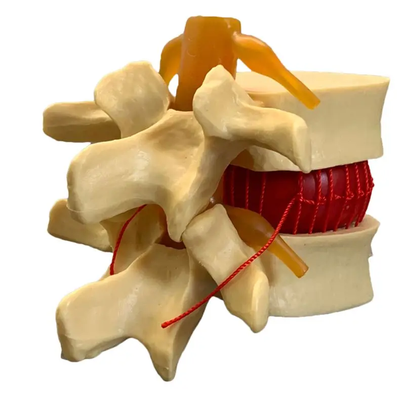 Vertebre lombari umane anatomi - Examination Bed Medical recensione e prezzo