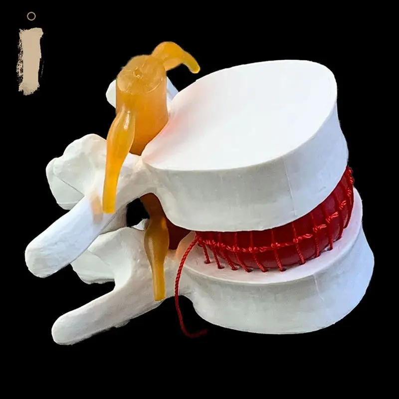 Vertebre lombari umane anatomi - Examination Bed Medical recensione e prezzo