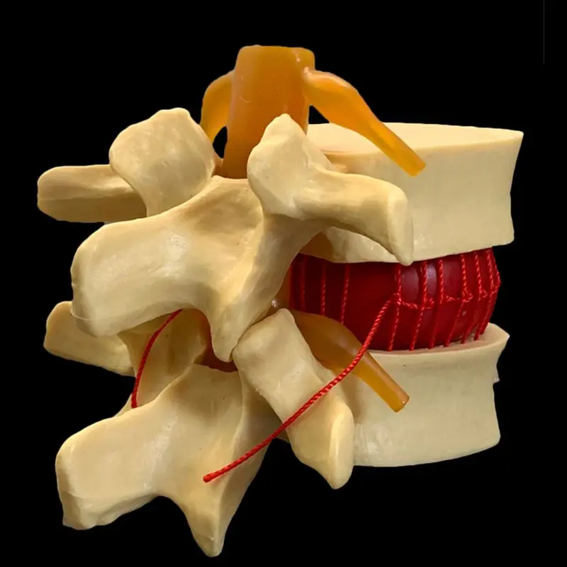 Vertebre lombari umane anatomi - Examination Bed Medical recensione e prezzo