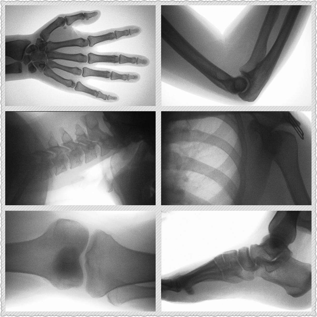 Diagnosi Rapida delle Fratture - Veterinary X-Ray recensione e prezzo